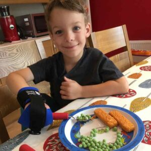 Child holding cutlery grips with mini gripping aid. Suitable for reduced hand function: tetra, quad, cerebral palsy, SCI, spinal cord injury, stroke and more.