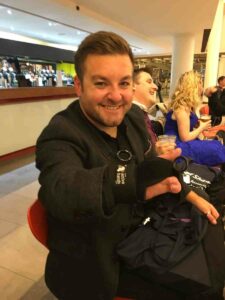 Comedian Alex Brooker wearing Active Hands Limb Difference aid