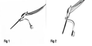 Diagram showing how the tubular clamp can be added to the tri-glide for the Soloc belts